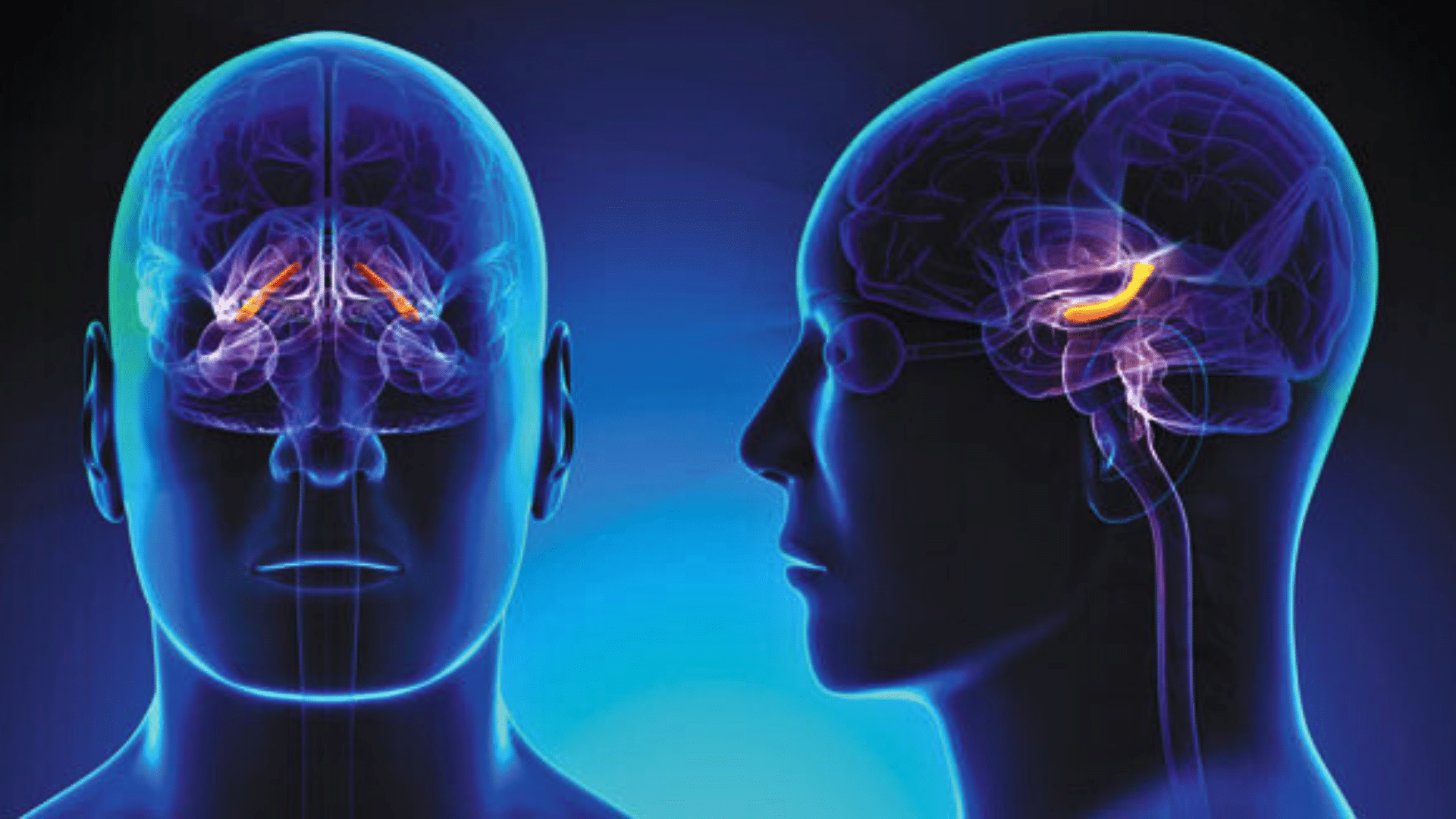 Intracranial
Stenting